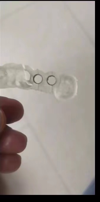 Resin Dental 3D Printer Planti - огляд і ціна 3D Printing Guide